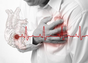 Aritmija srca – dijagnostika i terapija